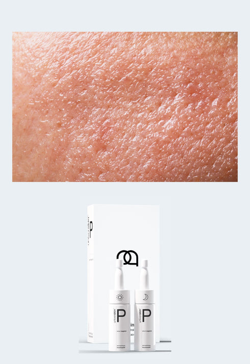 Prescription Medical Grade Oily Skin Skincare Treatment