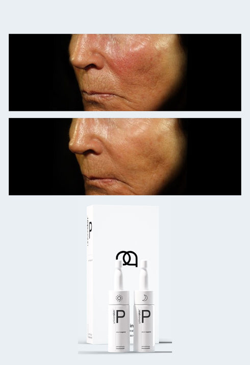 Prescription Medical Grade Redness Skincare Treatment