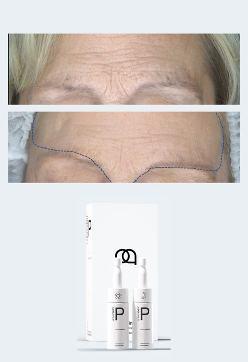 Prescription Medical Grade Smooth Skin Texture Skincare Treatment