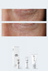 Personalised Medical Grade Prescription Skincare Treatment for Under Eye complete package