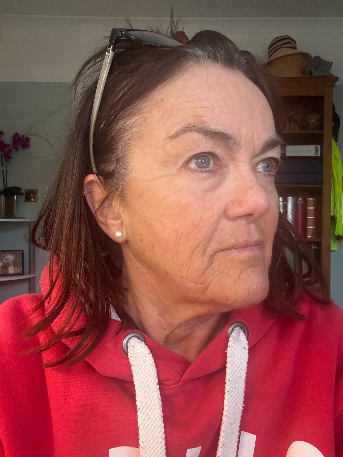 Origin Glass Laser anonymous full recovery journey Treatment 1 Day 16 recovery photo 2, showing full face, around the eyes, jawline and neck.