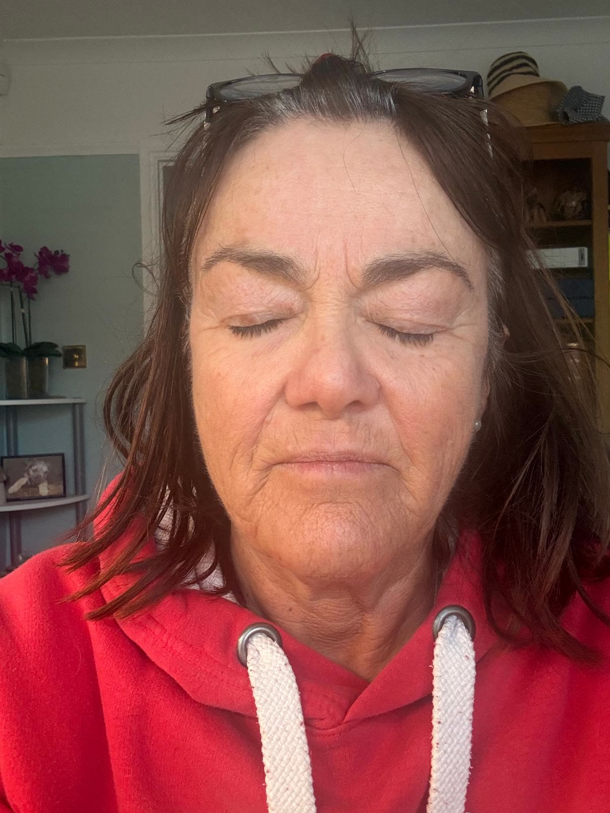 Origin Glass Laser anonymous full recovery journey Treatment 1 Day 16 recovery photo 6, showing full face, around the eyes, jawline and neck.