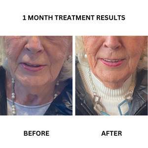 Before and after photographs from the existing "Reverse Ageing" - A Prescription Package of Medical Grade Skincare to Reverse the Signs of Ageing banner.