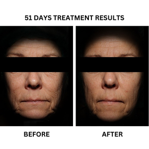 Before and after photographs from the existing "Youthful Radiance" - A Prescription Package of Medical Grade Skincare to treat Lines & Wrinkles banner.