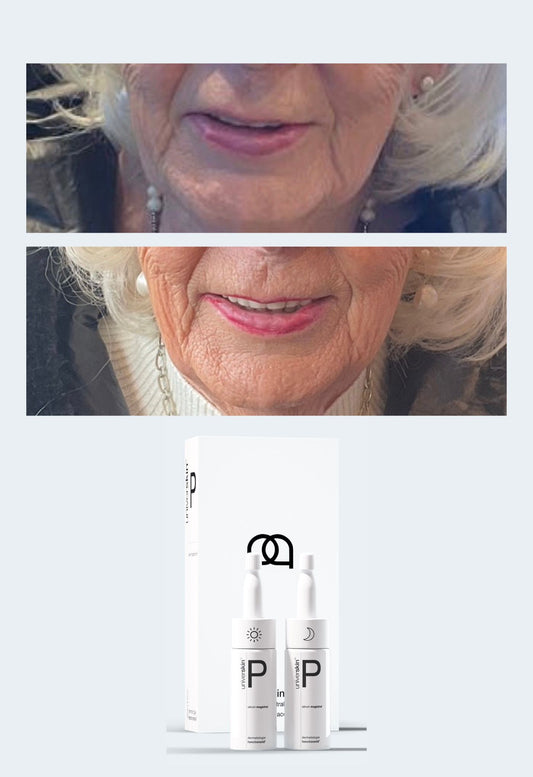 Prescription Medical Grade Anti-Ageing Skincare Treatment