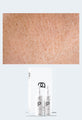 Prescription Medical Grade Eczema Skincare Treatment