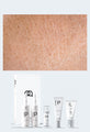 Personalised Medical Grade Prescription Skincare Treatment for Eczema complete package