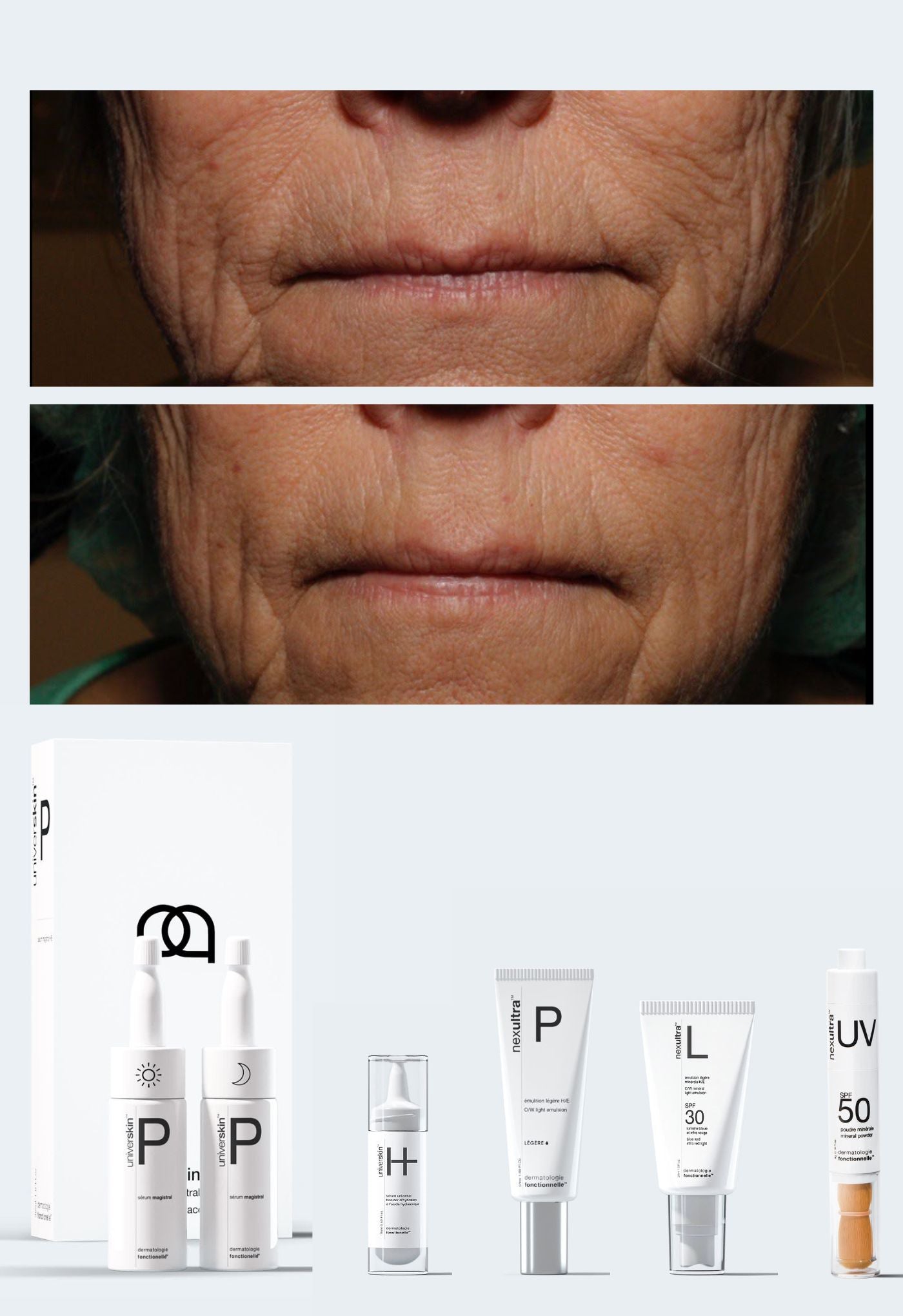 personalised medical grade prescription skincare treatment for sagging skin complete package
