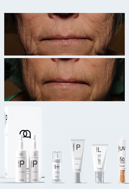 Personalised Medical Grade Prescription Skincare Treatment for Sagging Skin complete package
