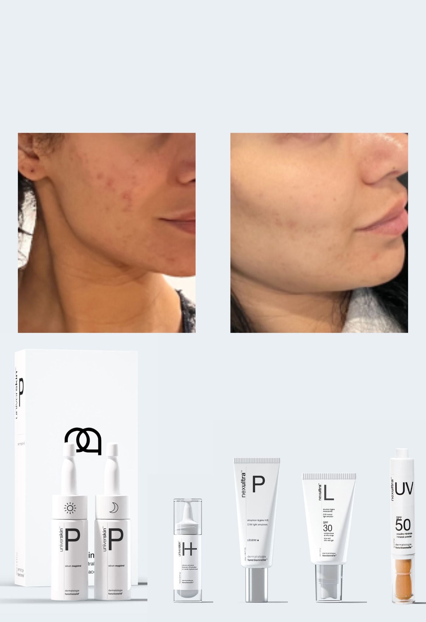 personalised medical grade prescription skincare treatment for clear complexion complete package