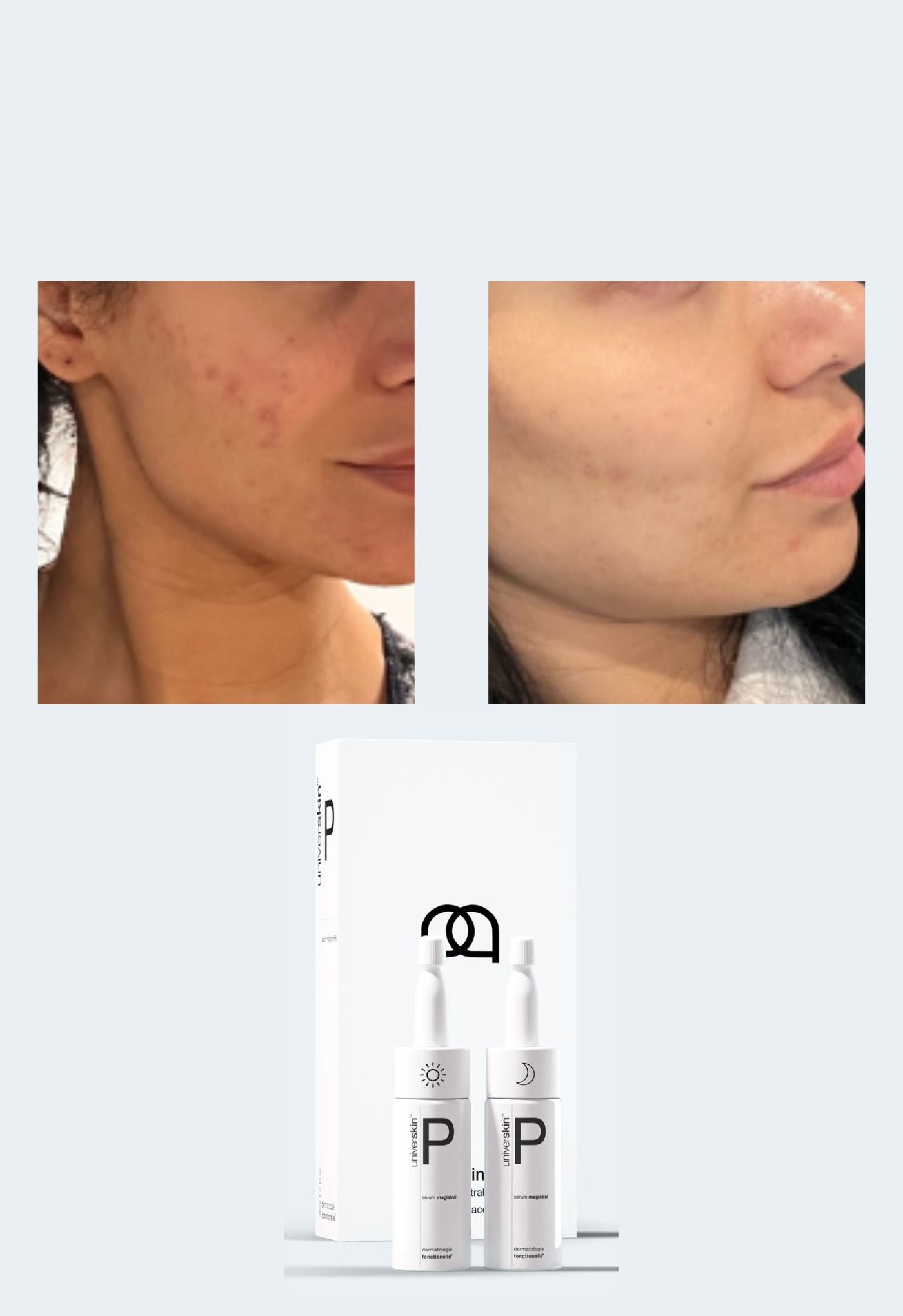 prescription medical grade skincare treatment for clear complexion