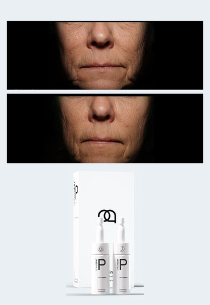 Prescription Medical Grade Anti-Wrinkles Skincare Treatment