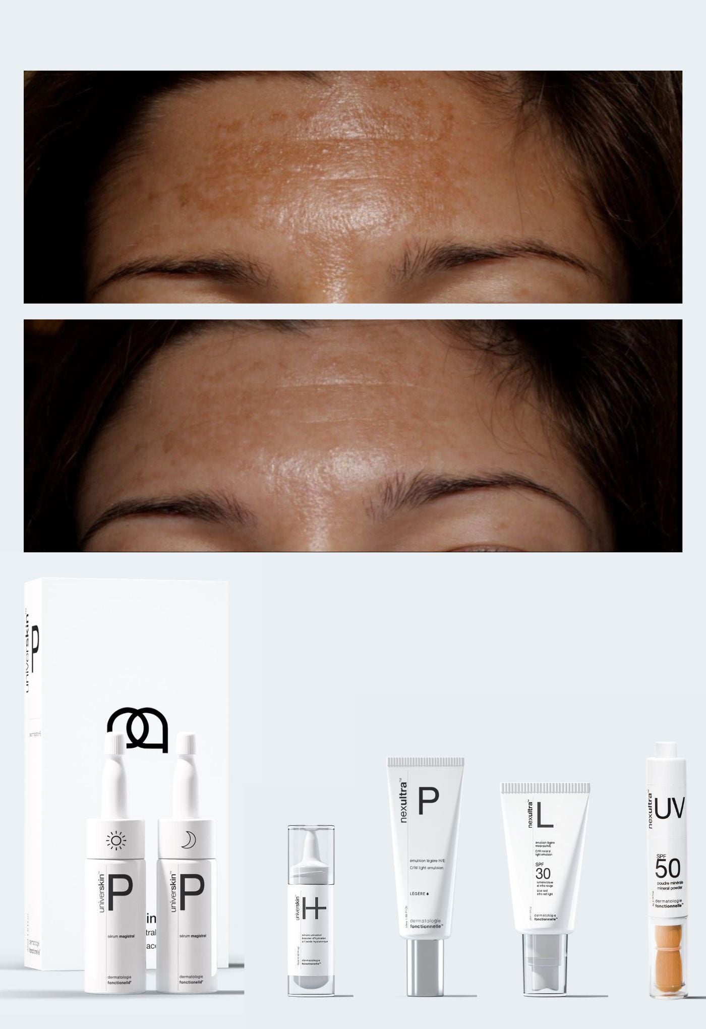 personalised medical grade prescription skincare treatment for melasma complete package
