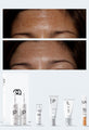 Personalised Medical Grade Prescription Skincare Treatment for Melasma complete package