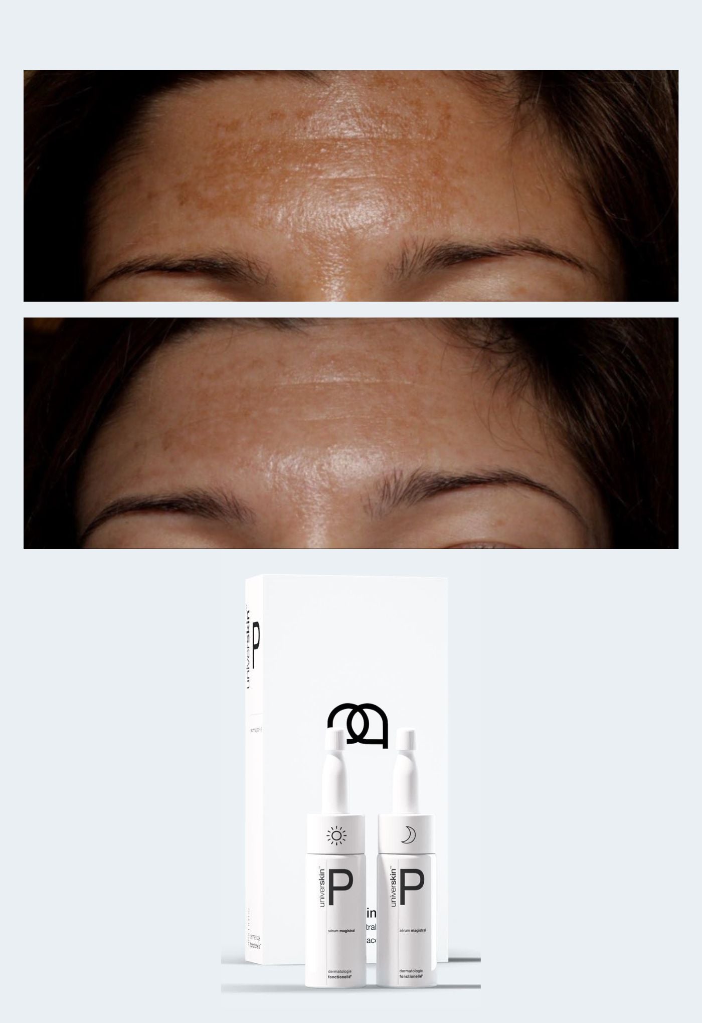 prescription medical grade melasma skincare treatment