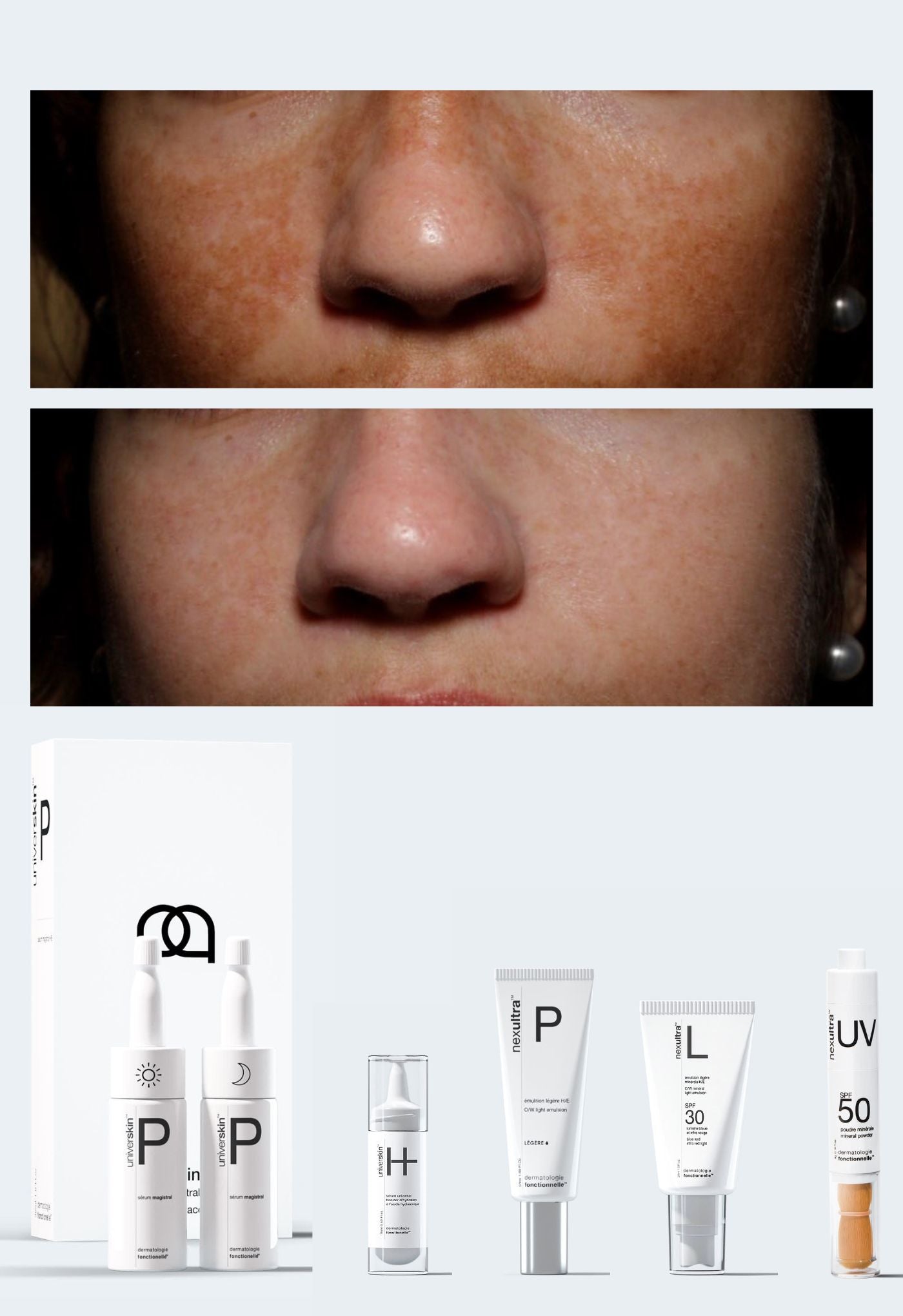 personalised medical grade prescription skincare treatment for pigmentation complete package
