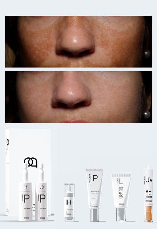 Personalised Medical Grade Prescription Skincare Treatment for pigmentation complete package
