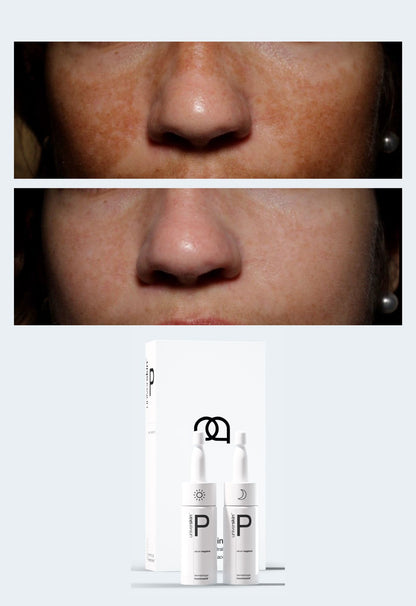 Prescription Medical Grade Hyperpigmentation Skincare Treatment