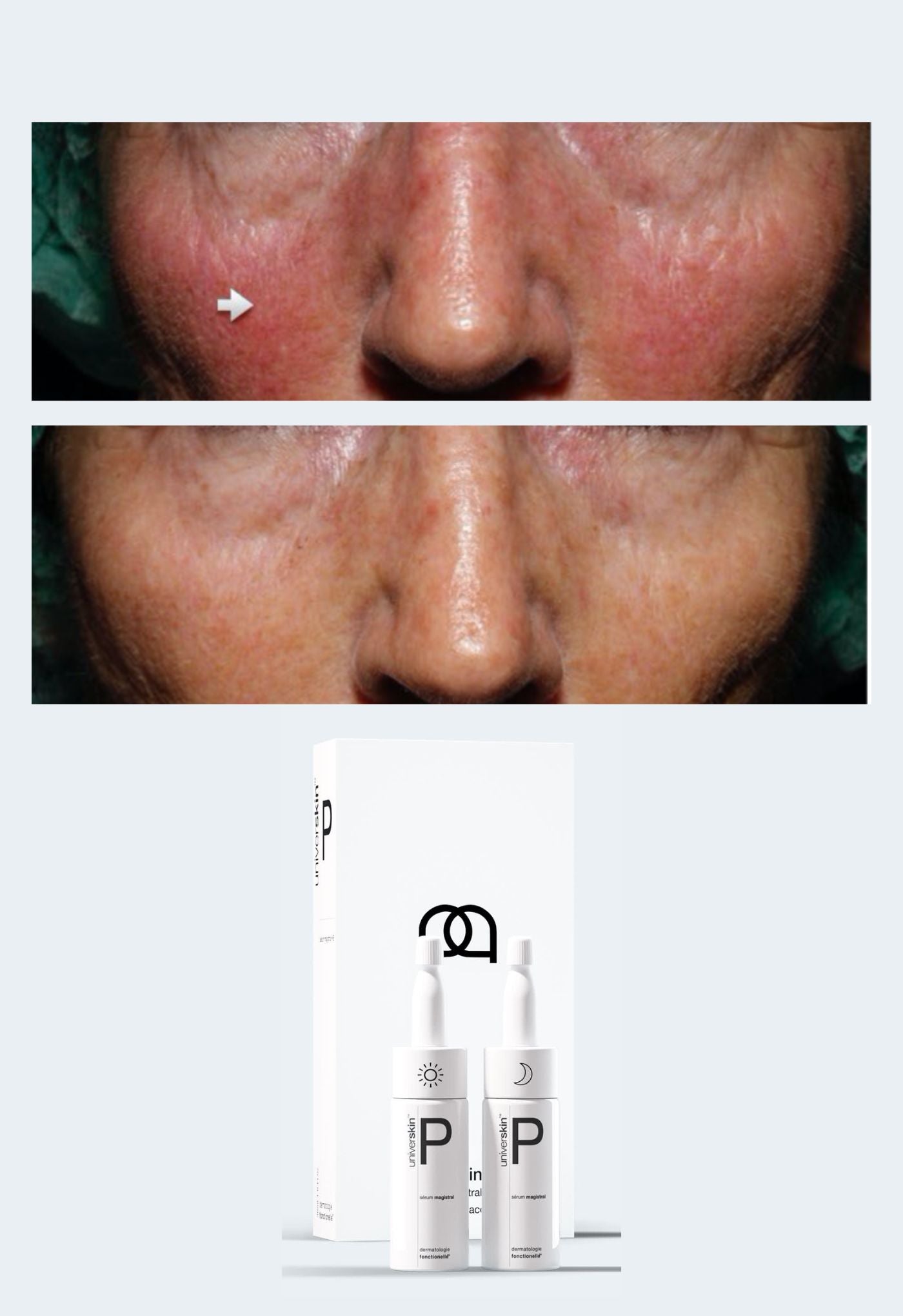 prescription medical grade rosacea skincare treatment