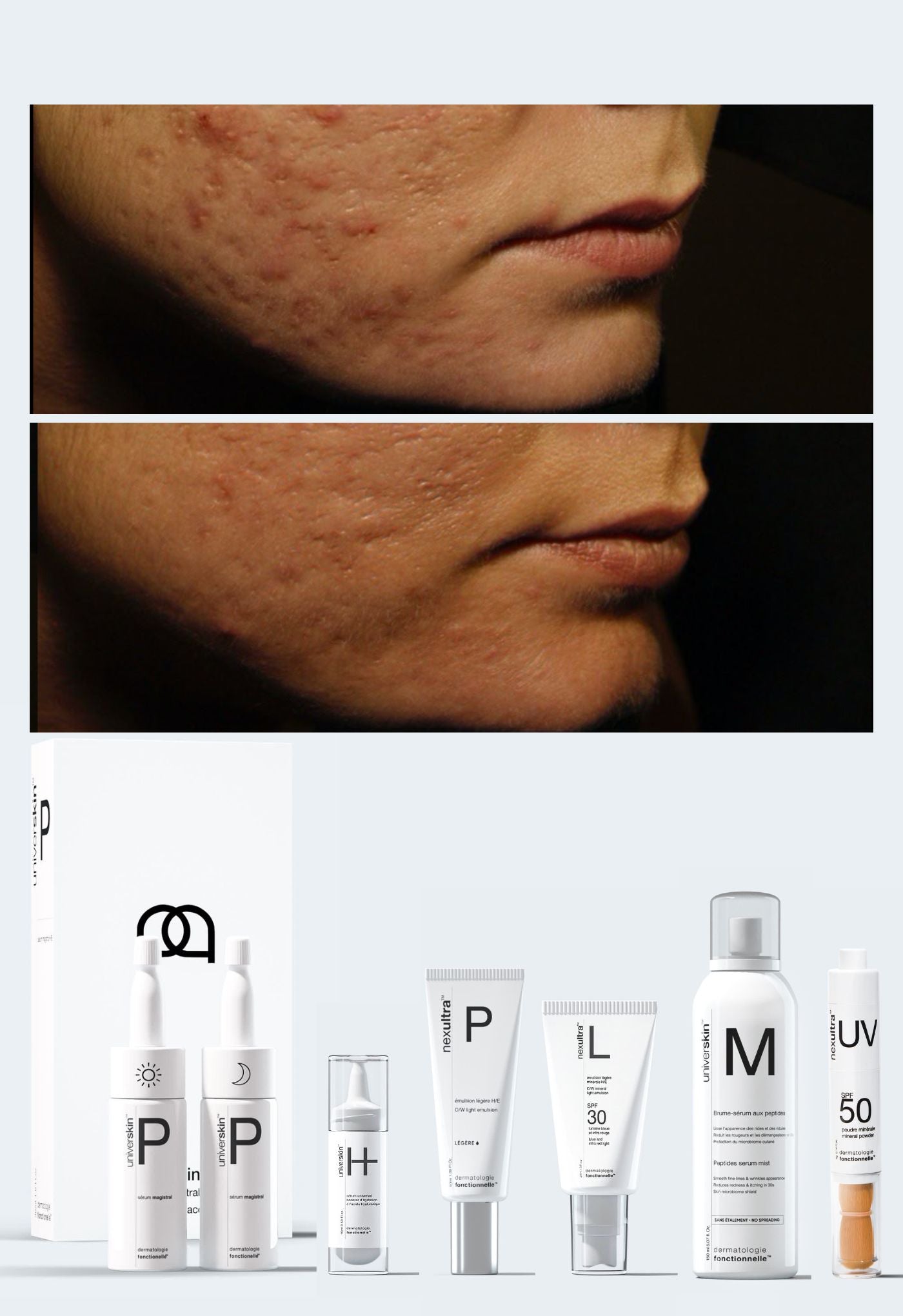 reverse skin scarring | personalised medical grade prescription skincare