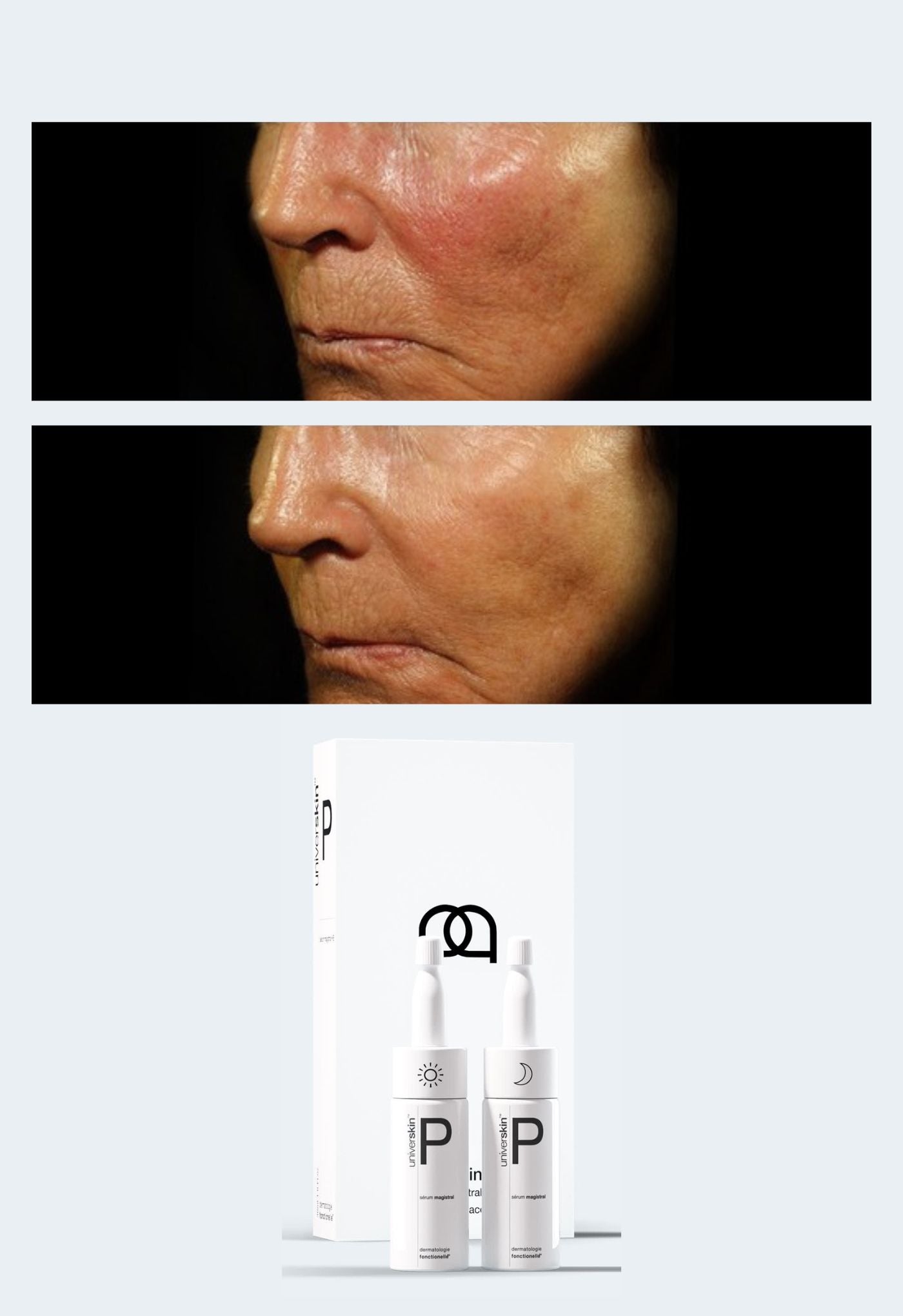 prescription medical grade redness skincare treatment