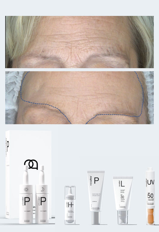 Skin Texture | Personalised Medical Grade Prescription Skincare