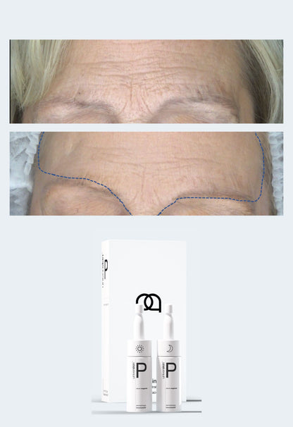 Prescription Medical Grade Smooth Skin Texture Skincare Treatment