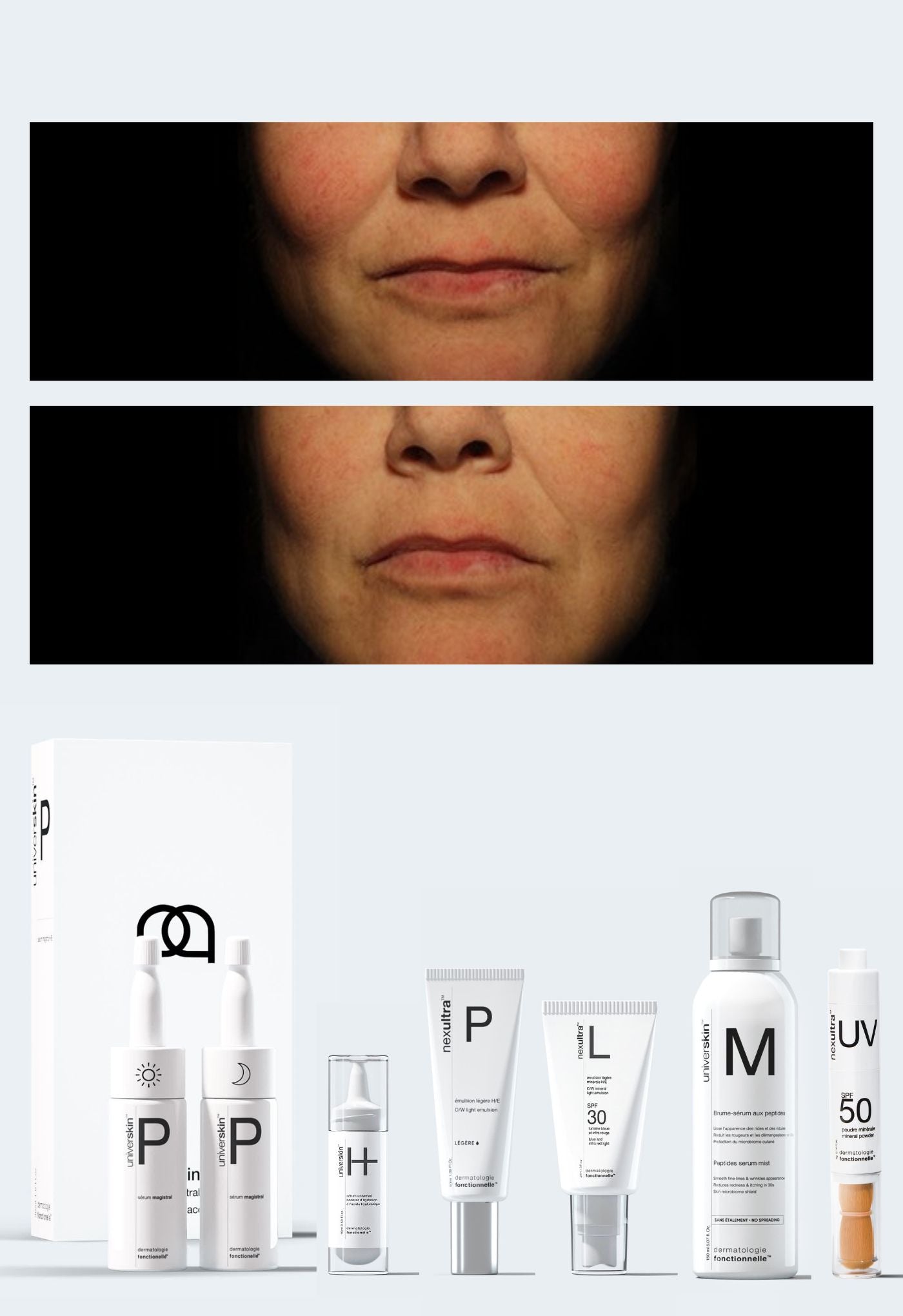 Personalised Medical Grade Prescription Skincare Treatment for Thread Veins complete package
