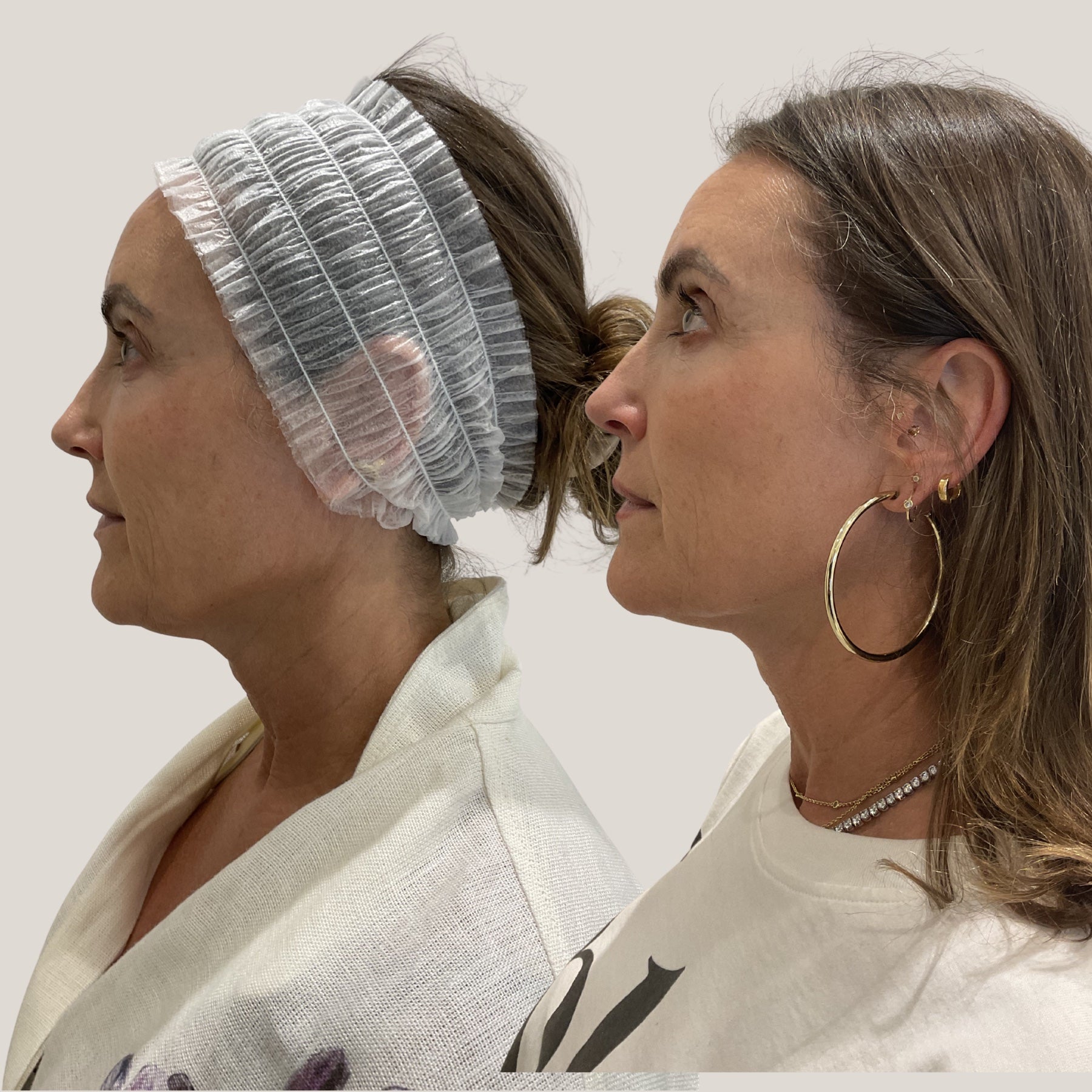 Dr Sknn profile skin rejuvenation before and after proof image